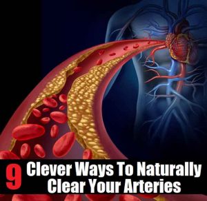 9 Clever Ways To Naturally Clear Arteries