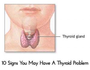 10 Signs You May Have A Thyroid Problem